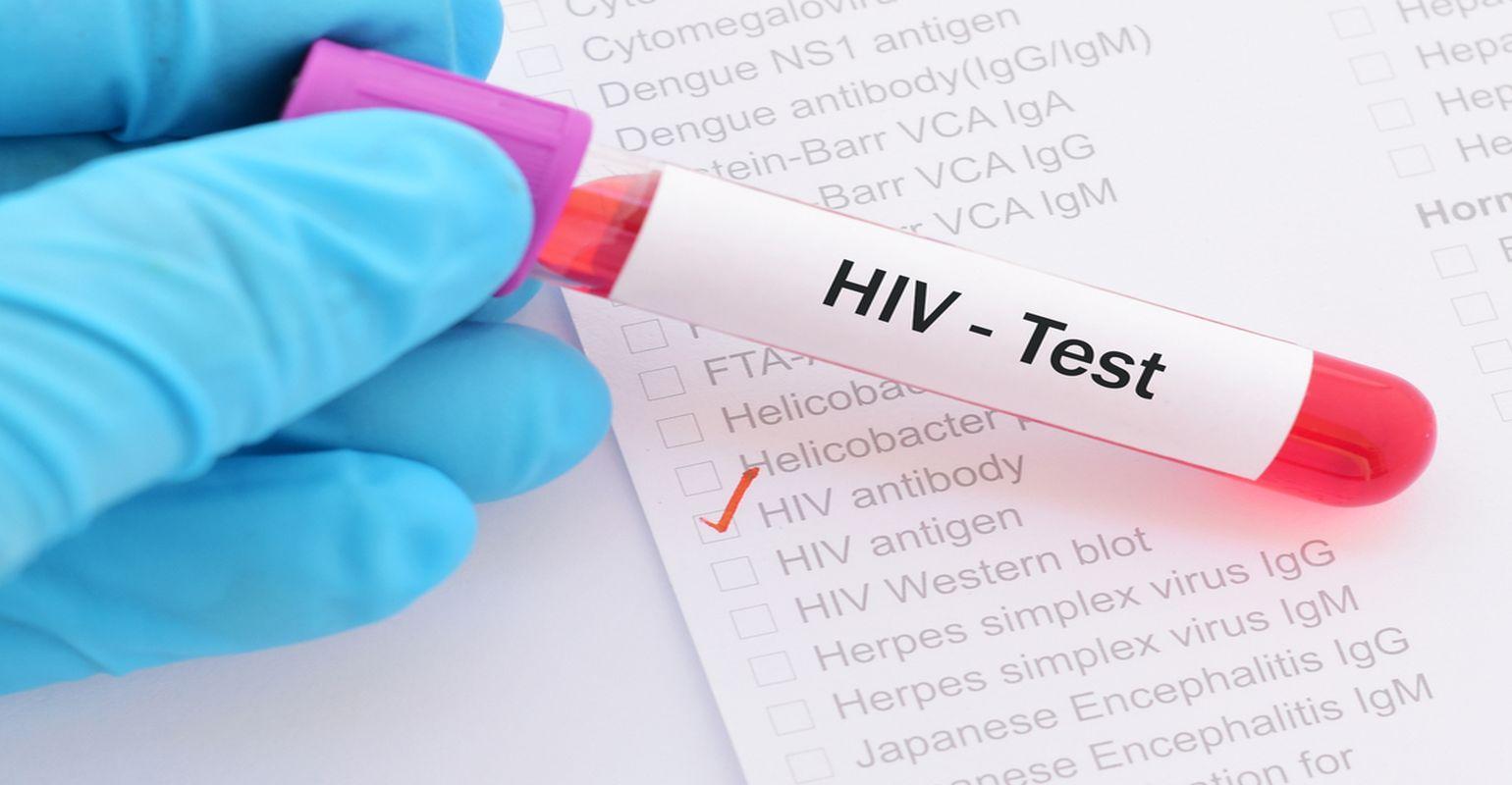 基因编辑技术新突破 成功清除9只活体内的HIV病毒
